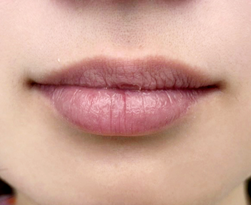 症例のビフォー画像