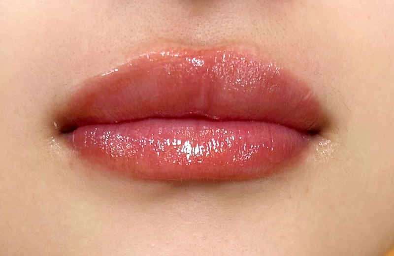 症例のアフター画像