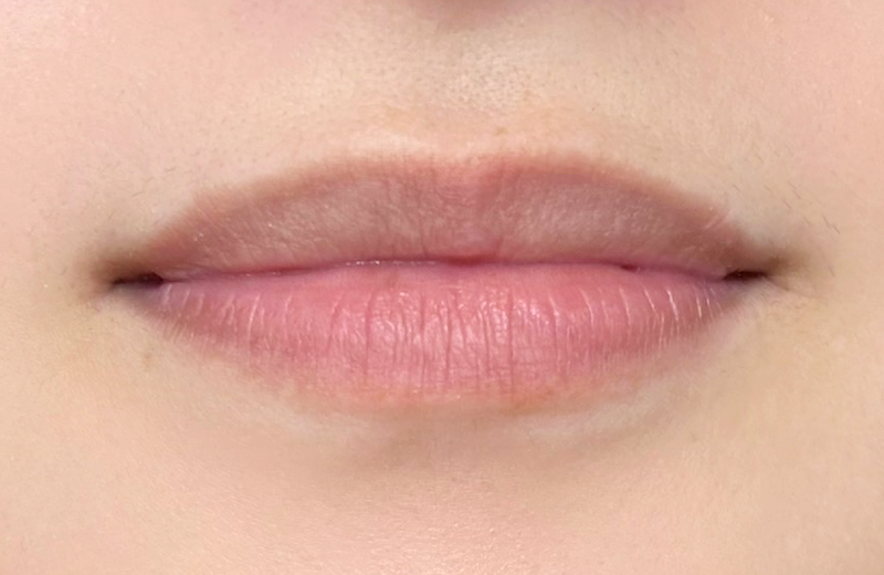 症例のビフォー画像