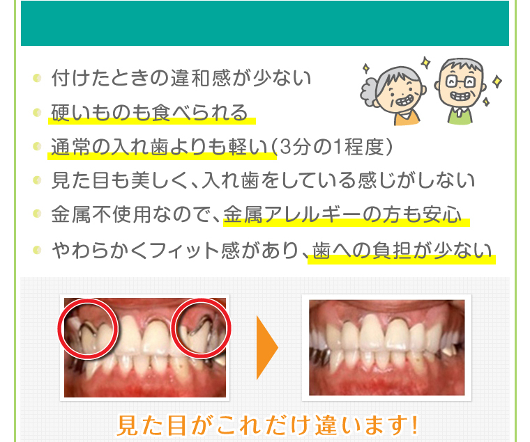付け心地・噛む力も抜群で毎日笑顔を!
