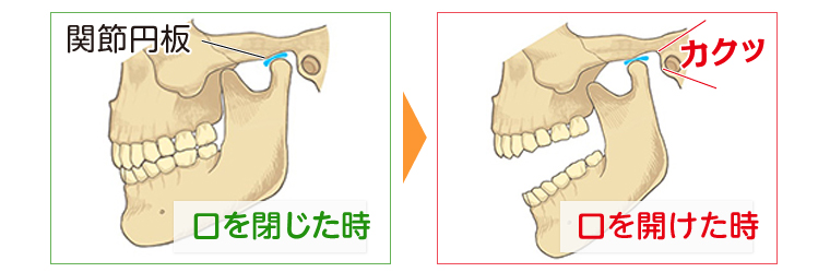 治療 法 関節 額 痛 症