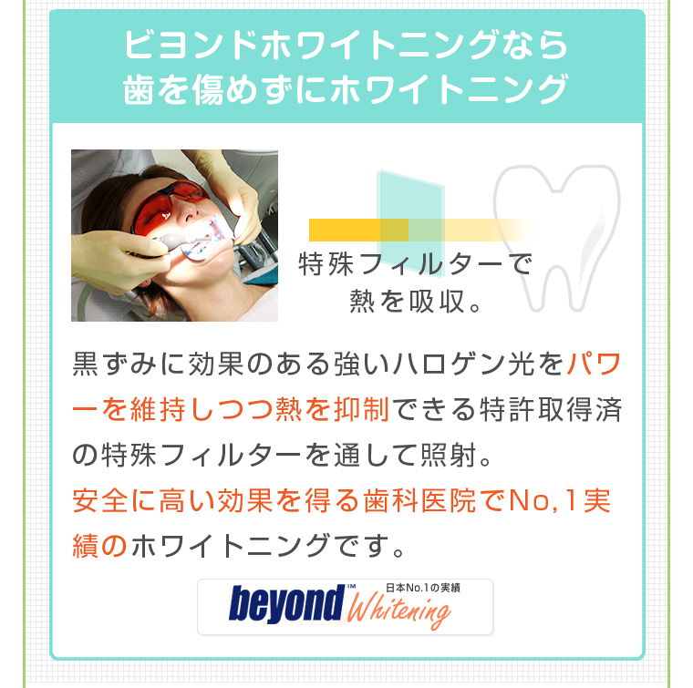 ビヨンドホワイトニングなら歯を傷めずにホワイトニング