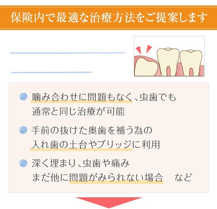 保険内で最適な治療方法をご提案します