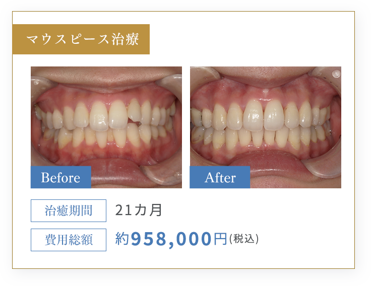 CASE1 施術内容