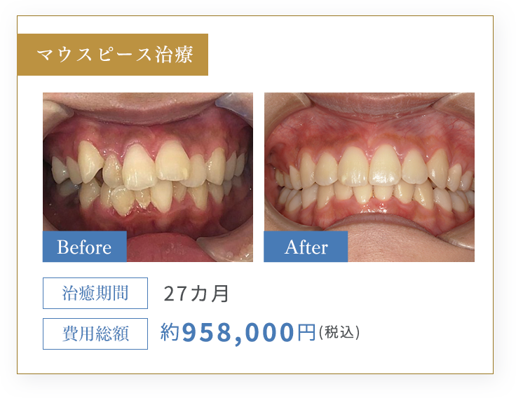 CASE3 施術内容