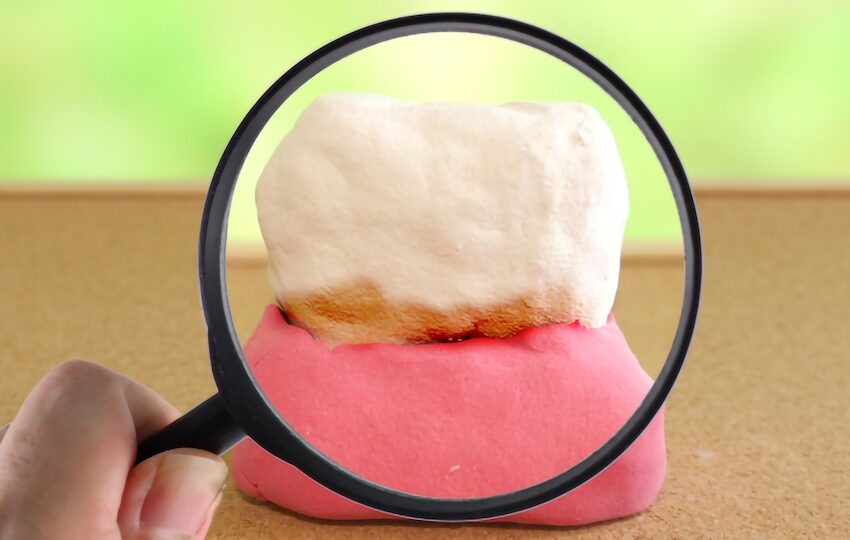 再発の原因は「見えない菌」と「習慣のズレ」 