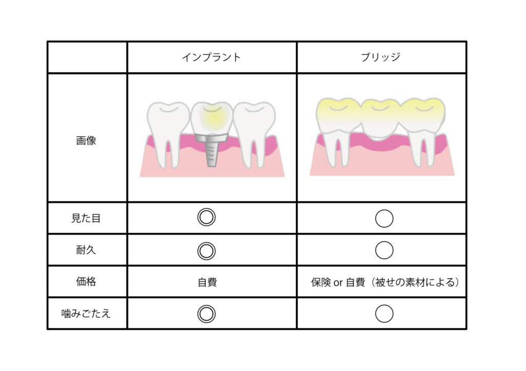 インプラントとブリッジの違い