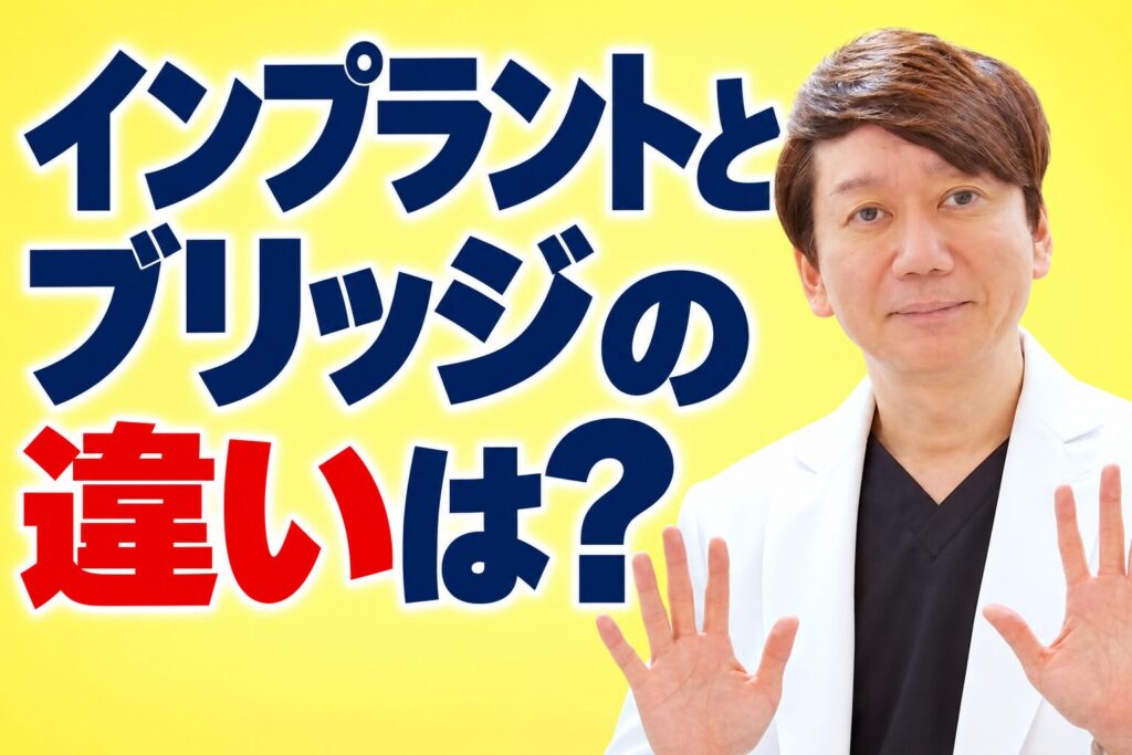 インプラントとブリッジの違いは？