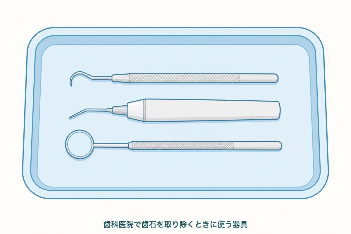 歯科医院で歯石除去に使う器具（スケーラー・超音波の先端・ミラー）を並べた図