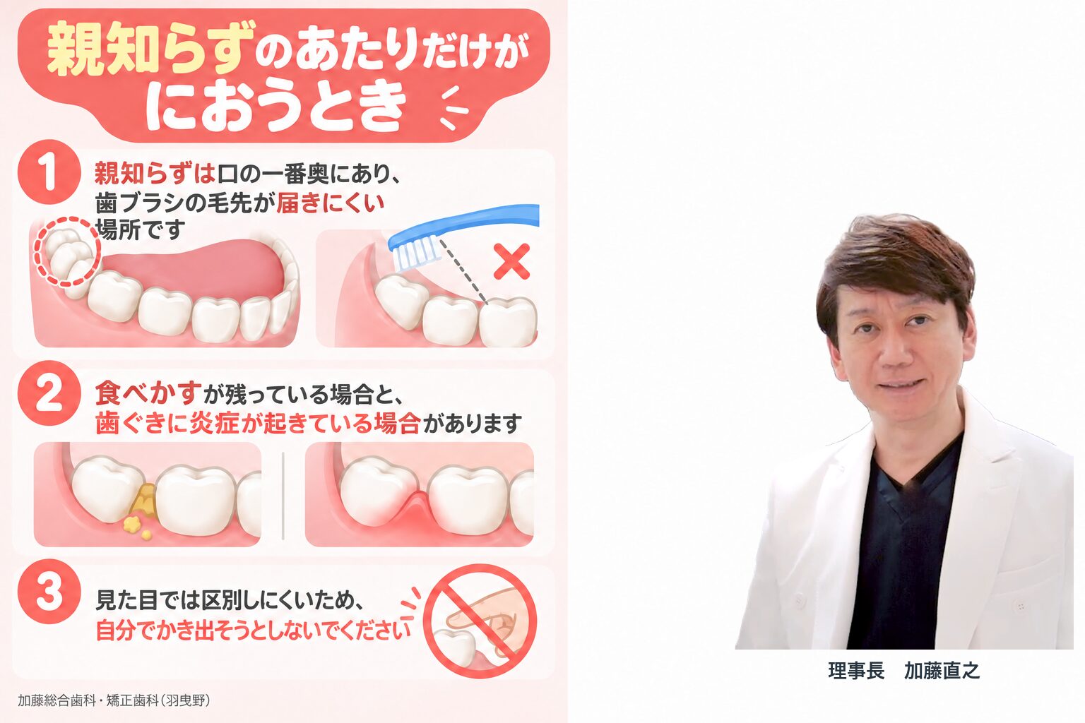 親知らずのあたりだけがにおうとき