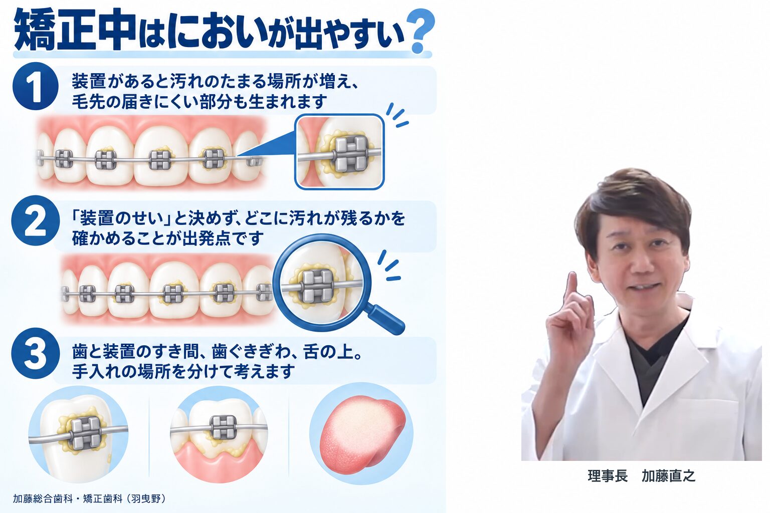 矯正中はにおいが出やすい?